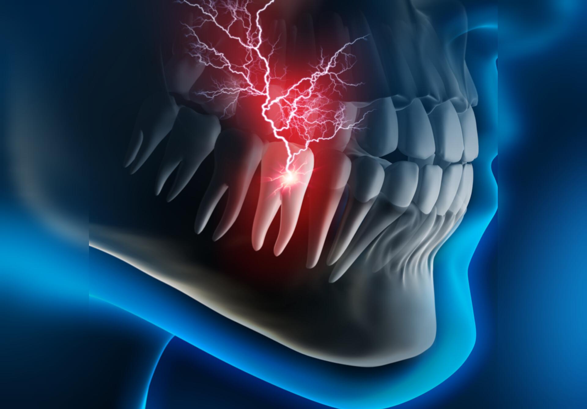 علائم و نشانه‌های نیاز به درمان ریشه دندان