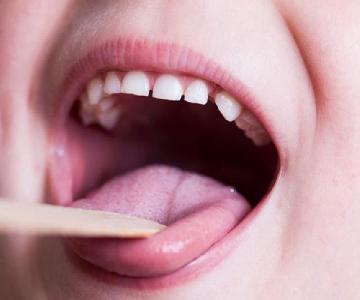 راه‌های پیشگیری از مشکلات دهان و دندان